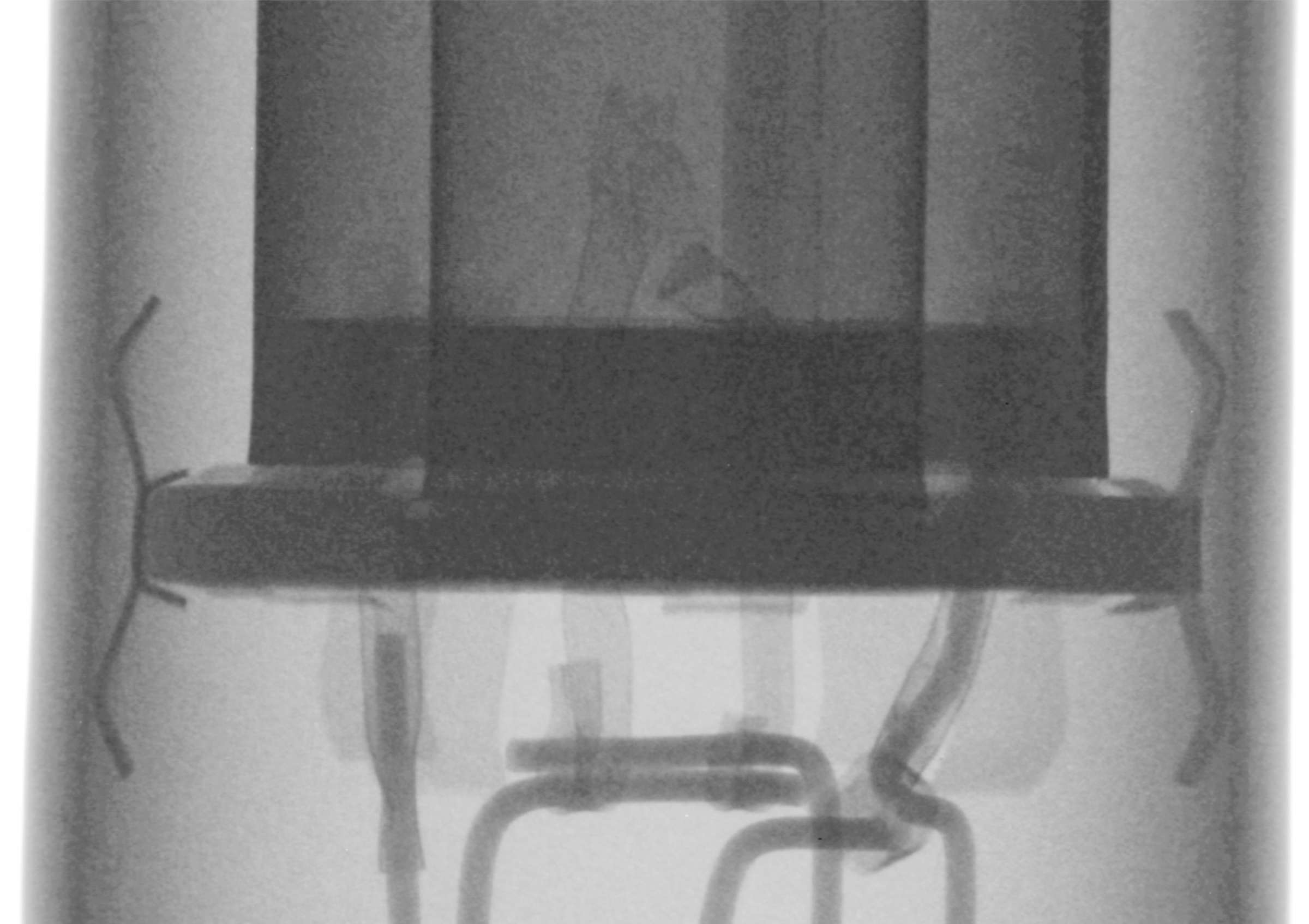 Рентгенография радиолампы СГ15П-2